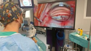 El Hospital de Riotinto perfecciona la cirugía de glaucoma con un procedimiento mínimamente invasivo
